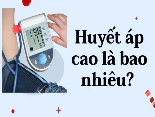 Huyết áp cao là bao nhiêu? Chỉ số và cách kiểm soát hiệu quả