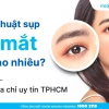 Cắt mí mắt bao nhiêu tiền? Bảng giá chi tiết và địa chỉ uy tín 2026