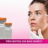 Tiêm Filler Thon Gọn Mặt Giá Bao Nhiêu? Yếu Tố Ảnh Hưởng Chi Phí