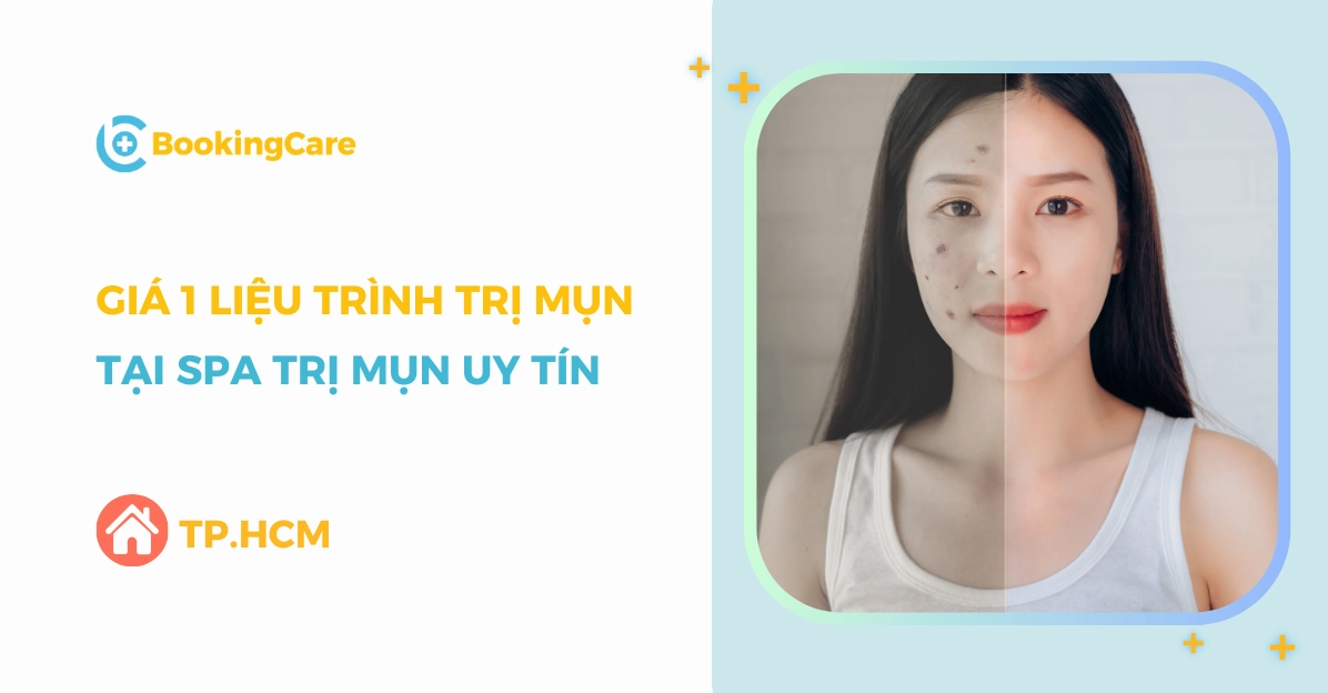 1 liệu trình trị mụn tại spa bao nhiêu tiền năm 2026?