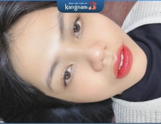 Bệnh viện thẩm mỹ Kangnam - Địa chỉ uy tín cho dịch vụ xăm môi