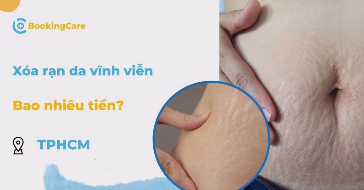 Cận cảnh vùng da bị rạn trước và sau khi điều trị bằng laser