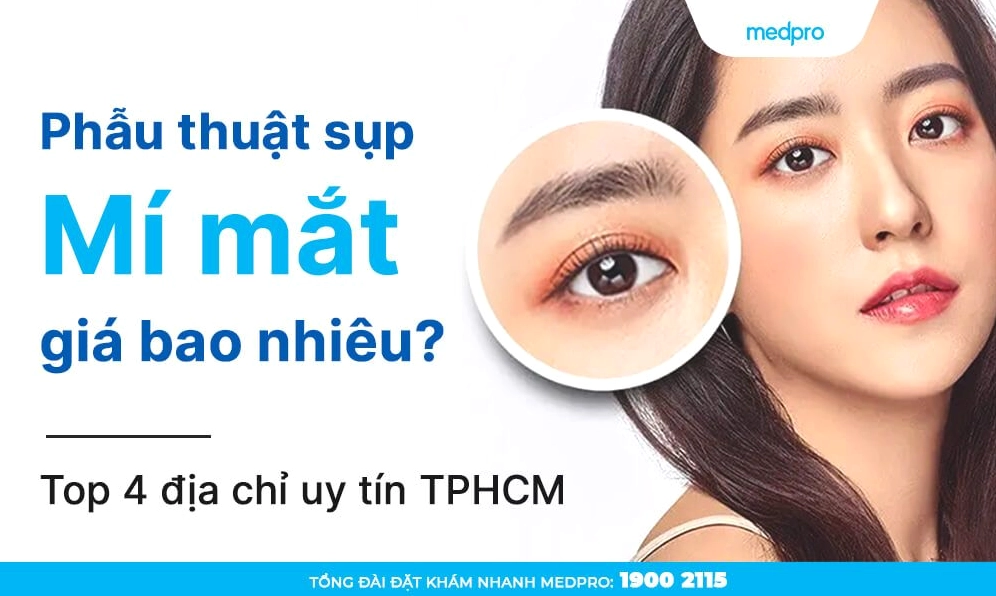 Cắt mí mắt bao nhiêu tiền? Bảng giá chi tiết và địa chỉ uy tín 2026