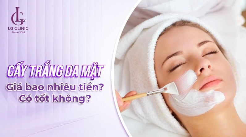Cấy trắng da mặt giá bao nhiêu? Phân tích chi tiết chi phí và quy trình 2026