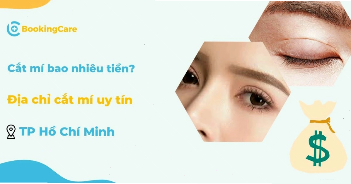 Địa chỉ cắt mí uy tín tại TP.HCM