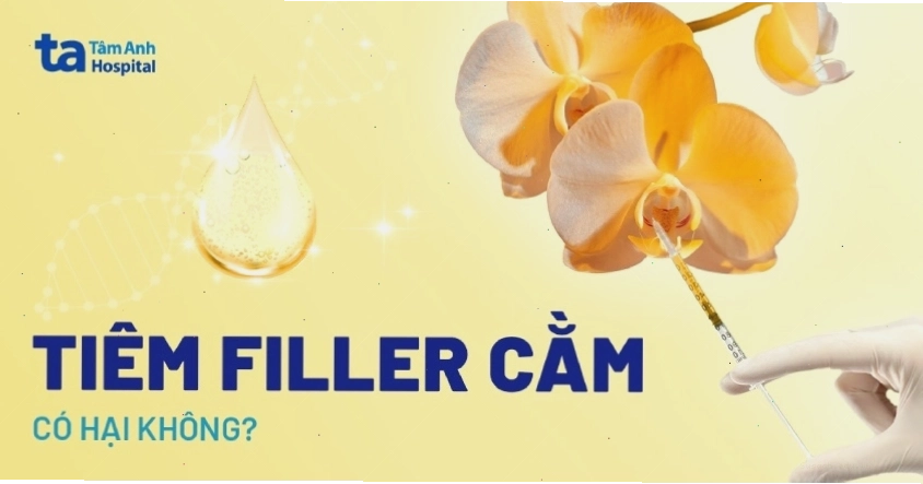 Hình ảnh minh họa dáng cằm đẹp sau khi tiêm filler