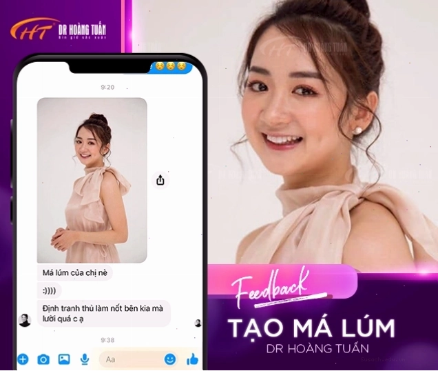 Khách hàng hài lòng với kết quả tạo má lúm đồng tiền tự nhiên