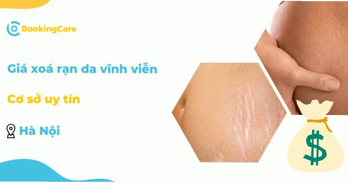 Không gian điều trị rạn da tại một phòng khám thẩm mỹ
