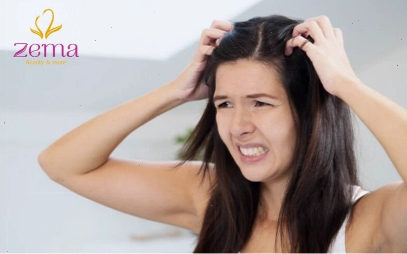 Không nối tóc khi da đầu có tổn thương