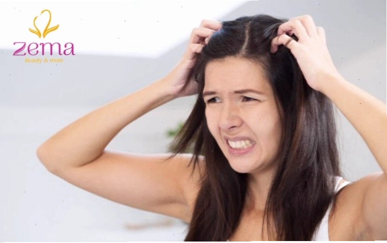 Không nối tóc khi da đầu đang có những tổn thương