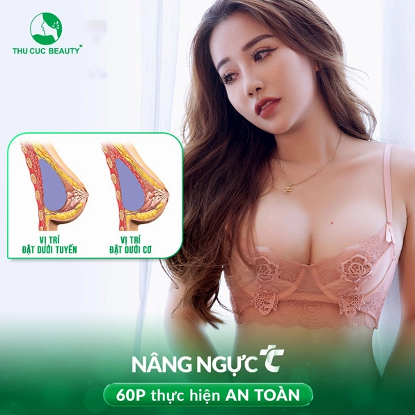 Nâng ngực giá bao nhiêu tiền? Cẩm nang chi tiết 2026