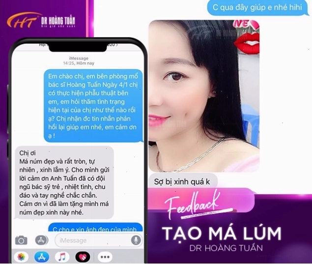 So sánh trước và sau khi tạo má lúm đồng tiền