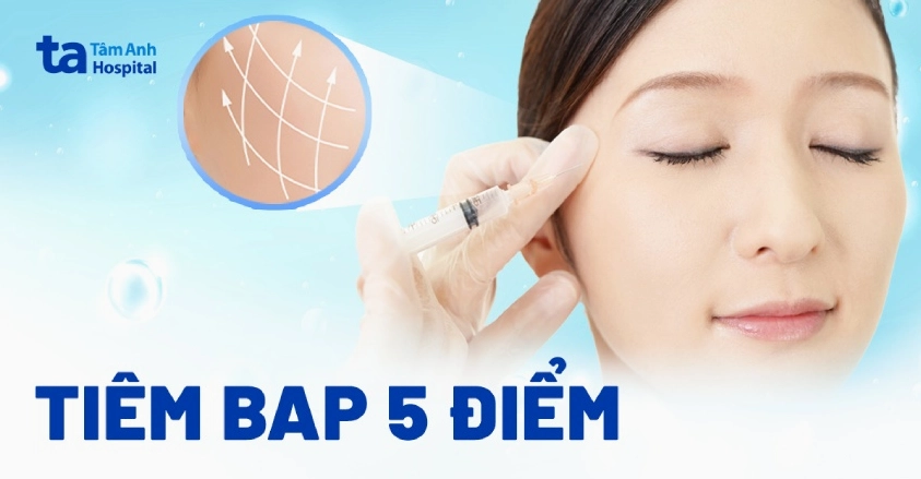 Tiêm BAP 5 điểm giá bao nhiêu? Khám phá chi tiết và lợi ích
