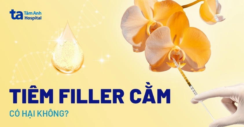 Tiêm Cằm Bao Nhiêu CC Là Đẹp Và An Toàn Nhất Năm 2026?