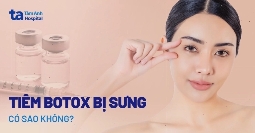Tình trạng sưng đau sau tiêm filler và cách xử lý