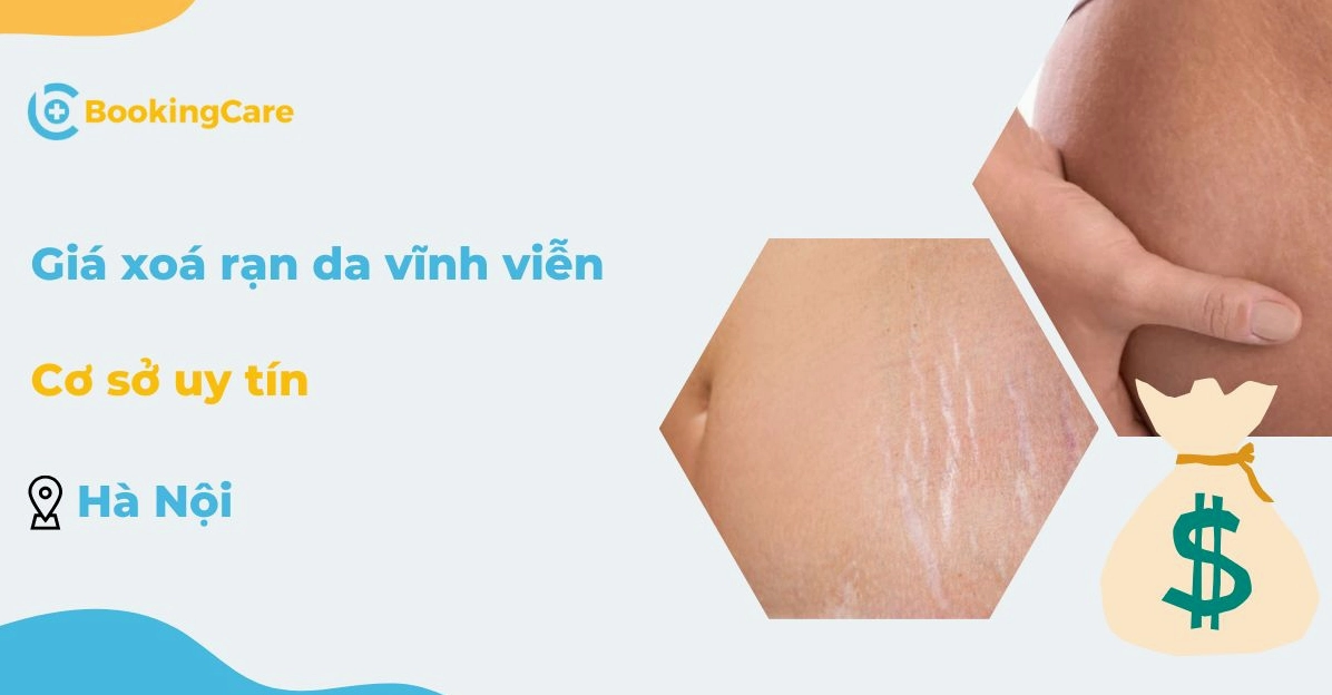 Trị Rạn Da Bằng Laser Bao Nhiêu Tiền? Cập Nhật Giá 2026