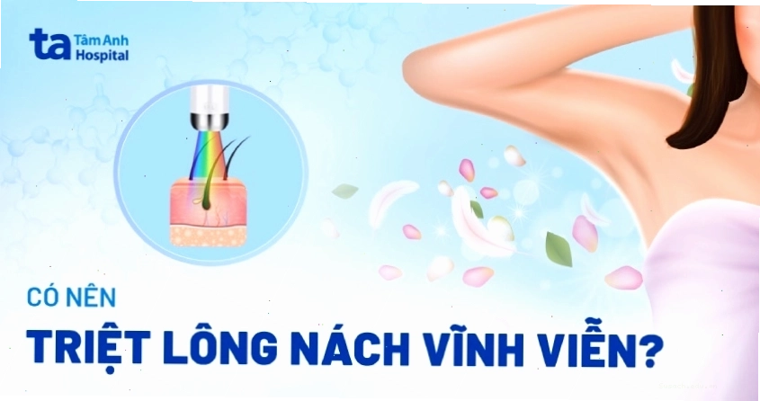 Triệt lông nách vĩnh viễn giúp vùng da dưới cánh tay sáng mịn hơn