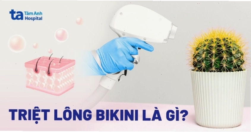 Triệt lông vùng kín nữ bằng công nghệ laser