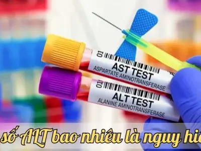 Chỉ số ALT bao nhiêu là nguy hiểm? Những dấu hiệu cảnh báo và giải pháp