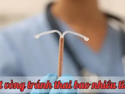 Đặt vòng tránh thai bao nhiêu tiền? So sánh chi phí tại các cơ sở y tế