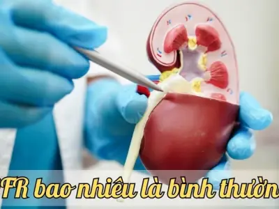 eGFR bao nhiêu là bình thường? Hướng dẫn đầy đủ về giá trị eGFR