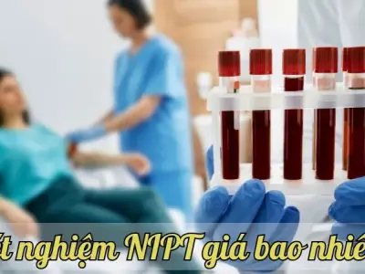Xét nghiệm NIPT giá bao nhiêu? cập nhật mới nhất năm nay