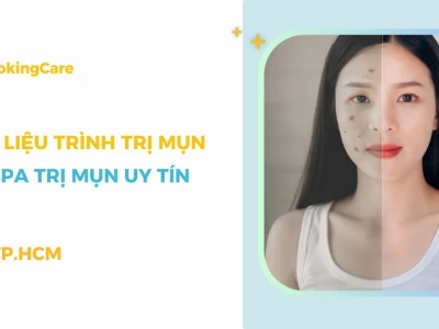 1 liệu trình trị mụn tại spa bao nhiêu tiền năm 2026?