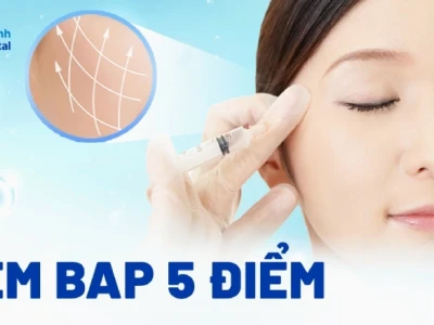 Tiêm BAP 5 điểm giá bao nhiêu? Khám phá chi tiết và lợi ích